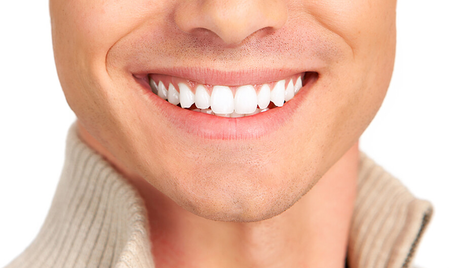 Bridges dental Bridges in nw calgary