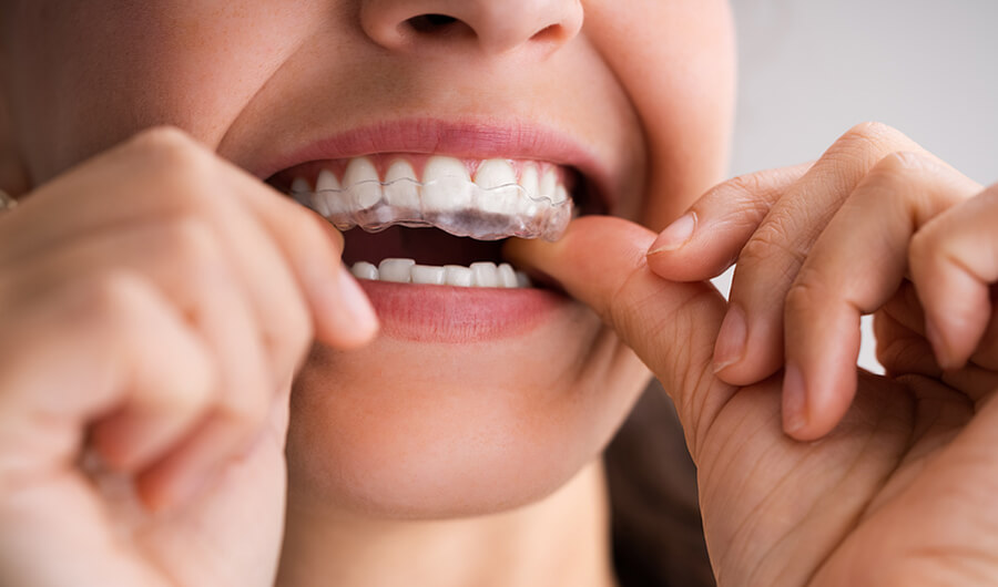 Mouth-Guard